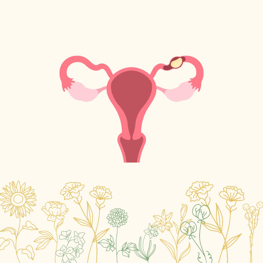 Ectopic Pregnancy: when an embryo takes a wrong turn