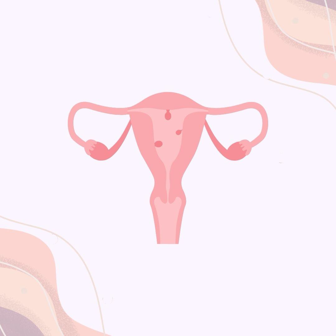 Polyps Demystified: a clear guide for patients